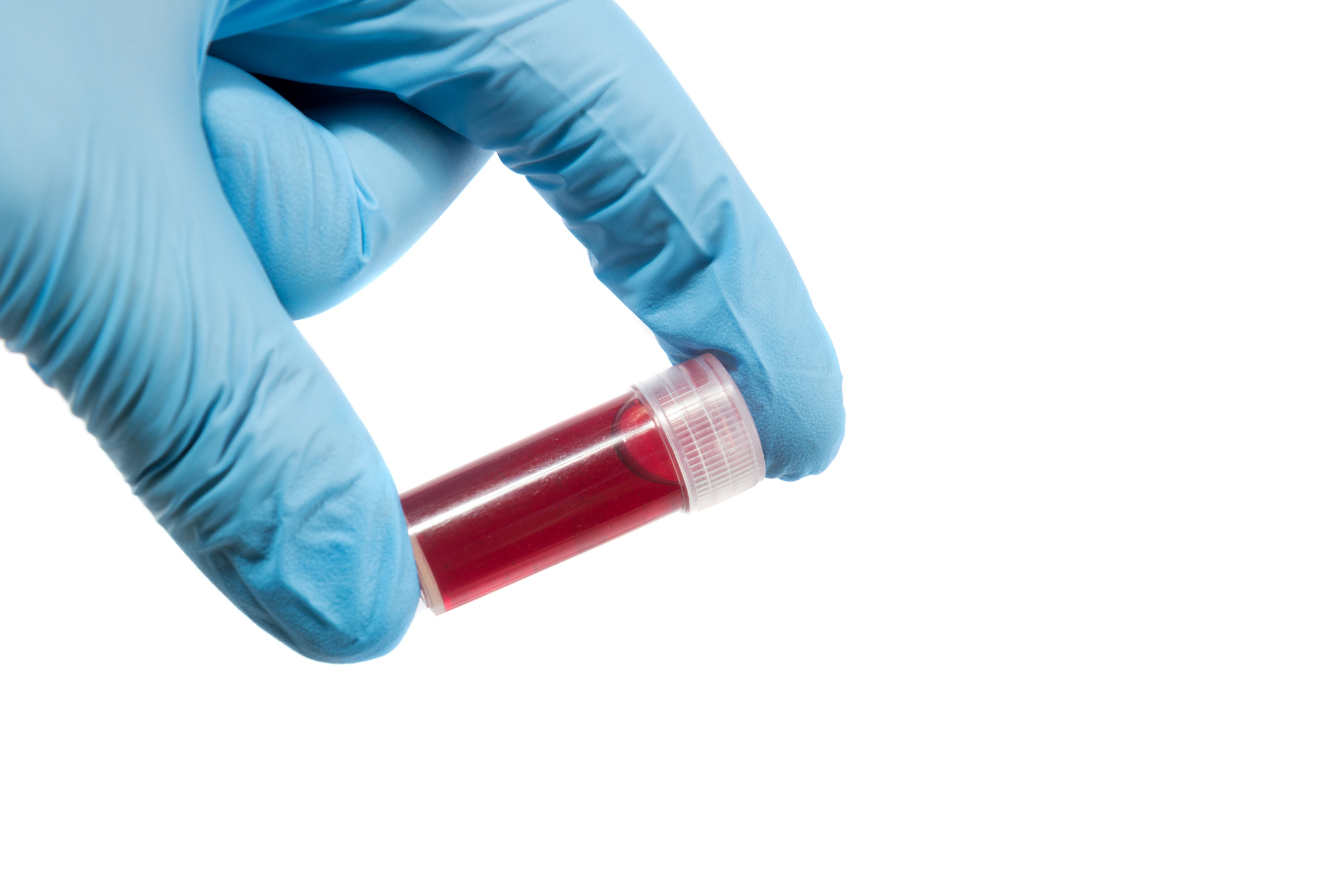 Achieving adequate capillary blood sample volume