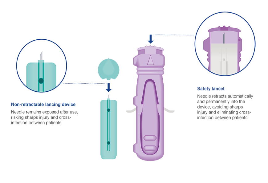 Benefits of safety lancets 