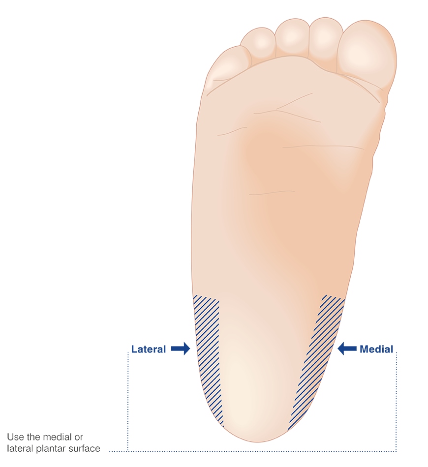 Heel site selection