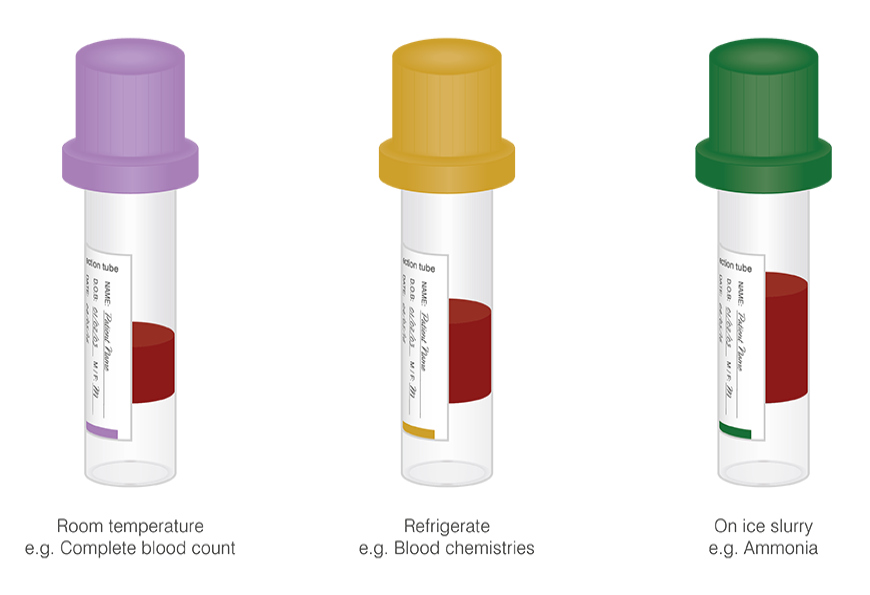 Storage and transport of capillary blood specimens 